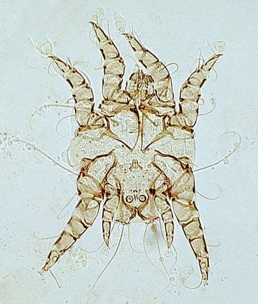 Photo of an ear mite, taken under a microscope.